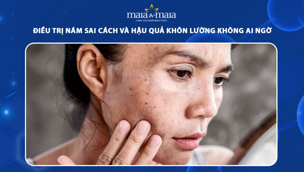 trị nám sai cách