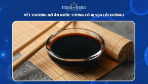 ăn nước tương có bị sẹo lồi không