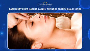 bấm huyệt chữa nám da