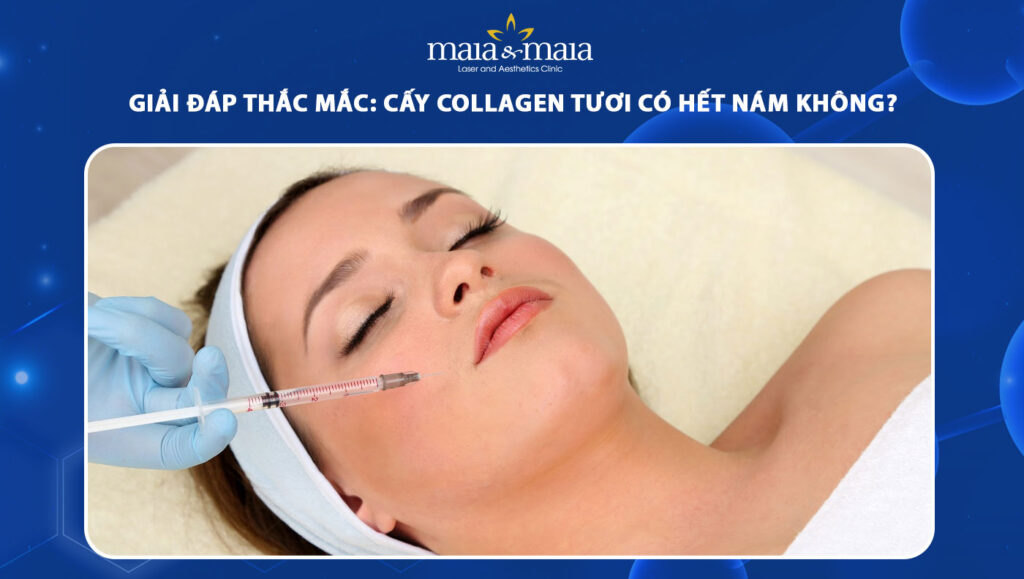 Lợi Ích Khác Của Cấy Collagen Tươi