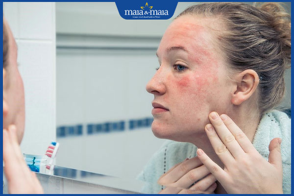 châm chích da khi dùng retinol