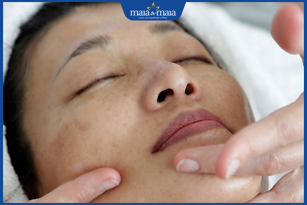 lợi ích khi bấm huyệt trị nám