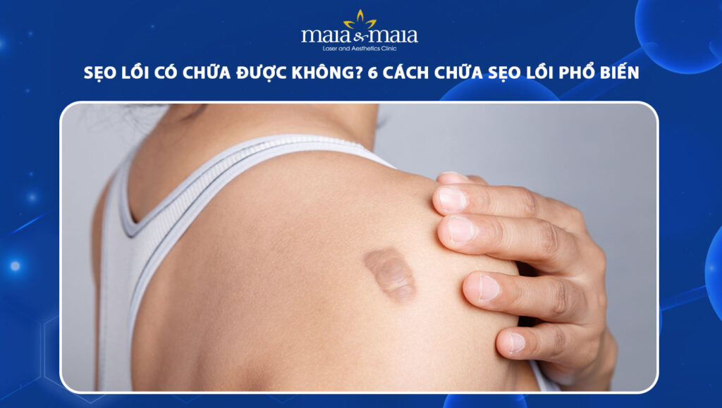 sẹo lồi có chữa được không