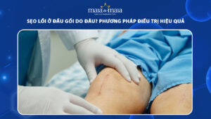 sẹo lồi ở đầu gối