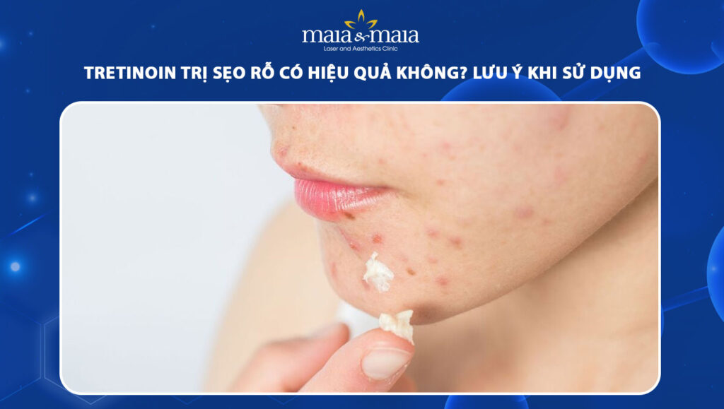 tretinoin trị sẹo rỗ