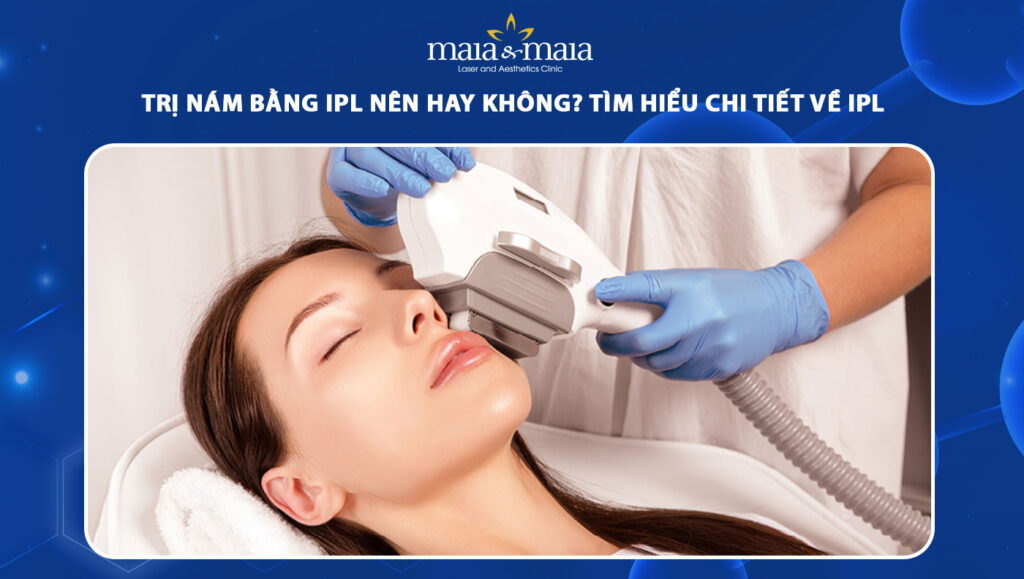 trị nám bằng ipl