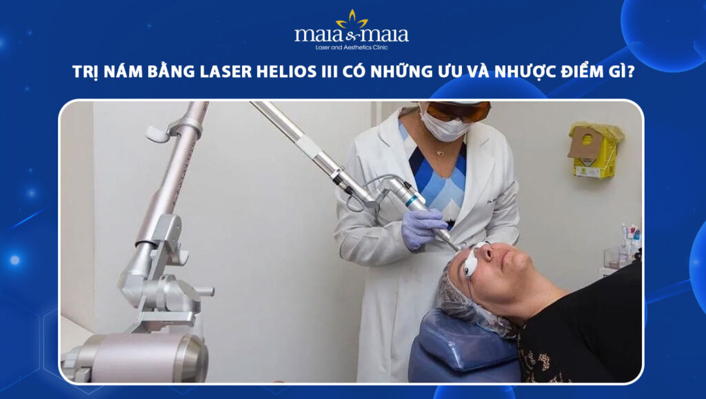 trị nám bằng laser helios III