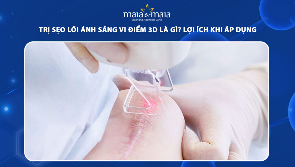 trị sẹo lồi ánh sáng vi điểm 3d