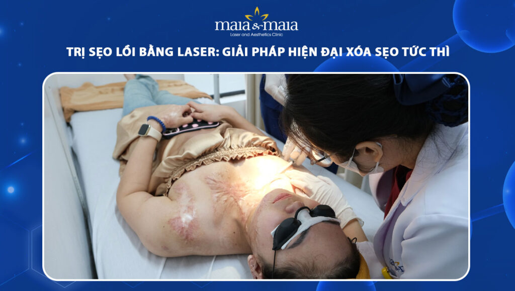 trị sẹo lồi bằng laser