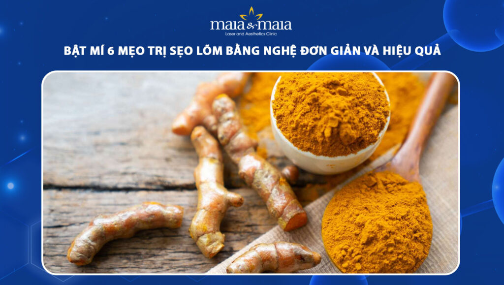 trị sẹo lõm bằng nghệ