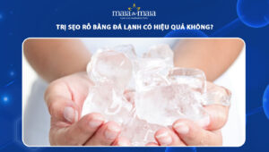 trị sẹo rỗ bằng đá lạnh