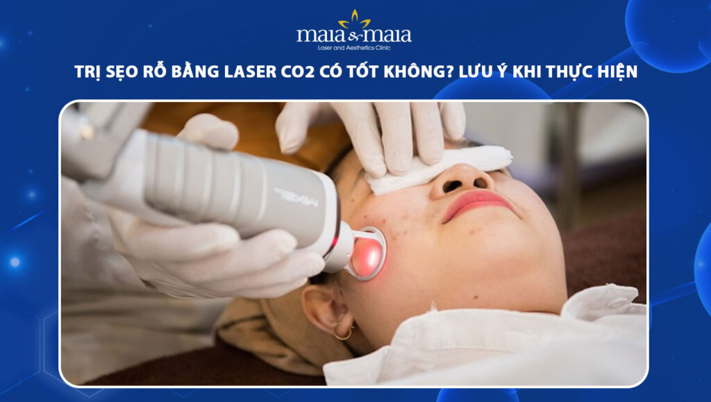 trị sẹo rỗ bằng laser co2