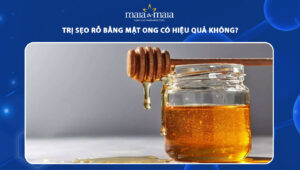 trị sẹo rỗ bằng mật ong