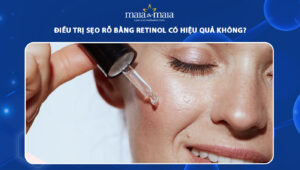 trị sẹo rỗ bằng retinol