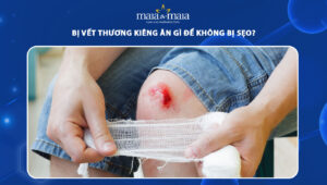 bị vết thương kiêng ăn gì để không bị sẹo