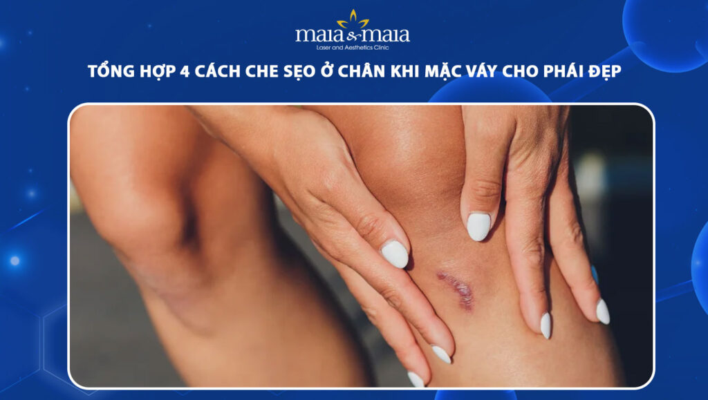 cách che sẹo ở chân khi mặc váy