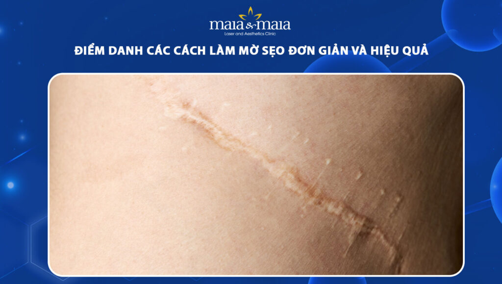 cách làm mờ sẹo