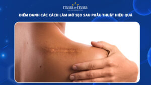 cách làm mờ sẹo sau phẫu thuật