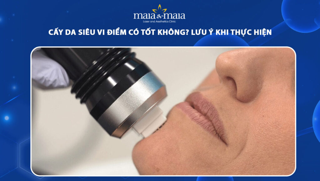 cấy da siêu vi điểm