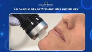 cấy da siêu vi điểm