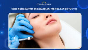 công nghệ maitrix btx