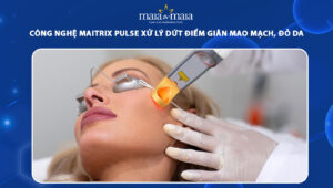 công nghệ maitrix pulse