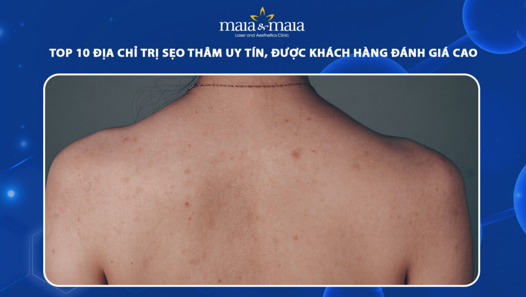 địa chỉ trị sẹo thâm