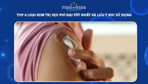 kem trị sẹo phì đại