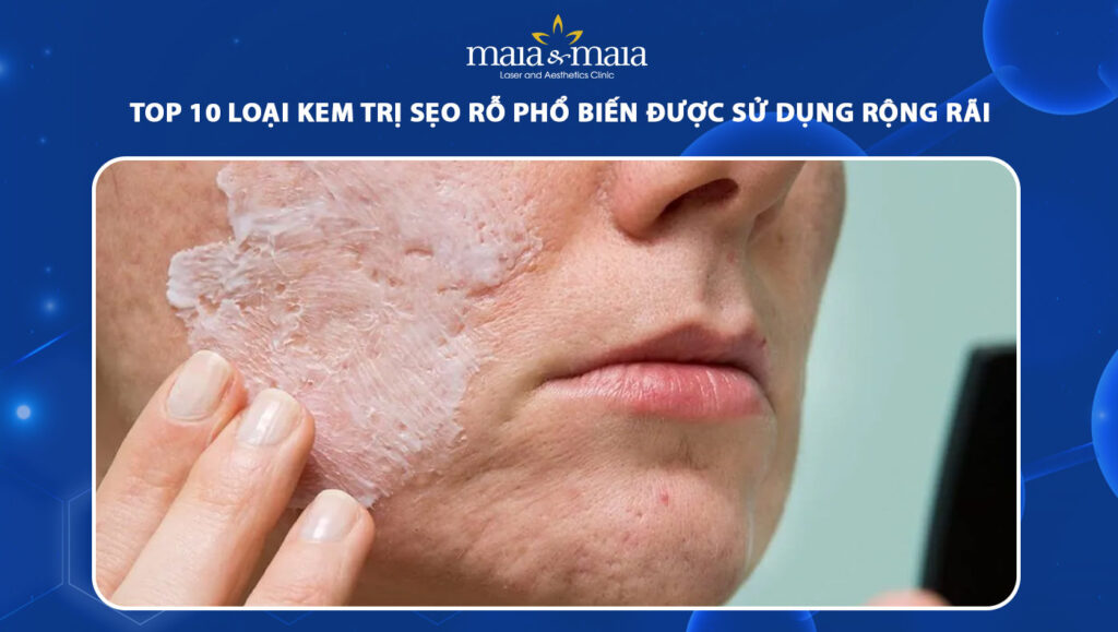 kem trị sẹo rỗ