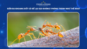 kiến ba khoang đốt có để lại sẹo không