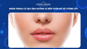 nhân trung có sẹo