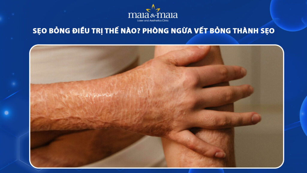 Sẹo bỏng điều trị thế nào? Phòng ngừa vết bỏng thành sẹo 1 sẹo bỏng