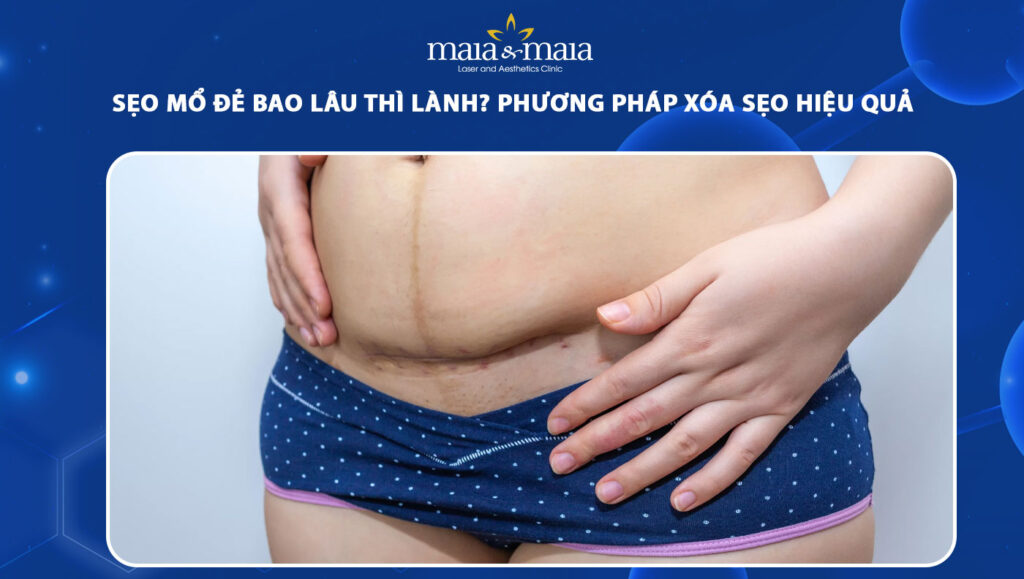 sẹo mổ đẻ bao lâu thì lành