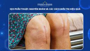 sẹo phẫu thuật