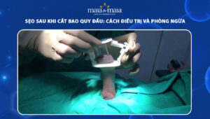 sẹo sau khi cắt bao quy đầu