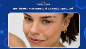 sẹo trên mặt