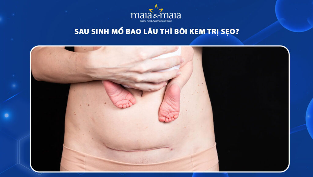 sinh mổ bao lâu thì bôi kem trị sẹo