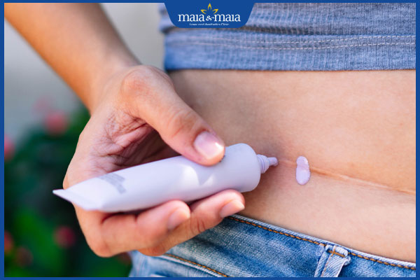 thoa kem trị sẹo thâm đỏ