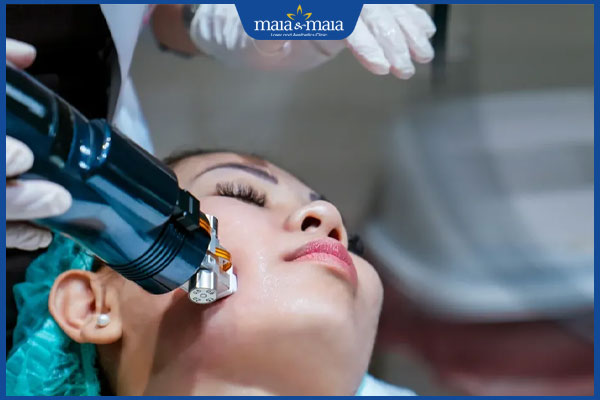 thực hiện cấy da siêu vi điểm