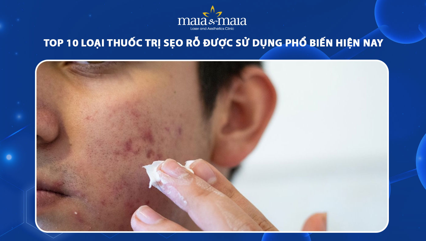 Top 10 loại thuốc trị sẹo rỗ được sử dụng phổ biến hiện nay