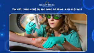 trị sẹo bỏng bô bằng laser