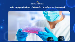 trị sẹo rỗ bằng tế bào gốc