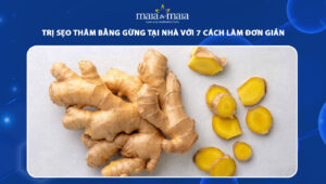 trị sẹo thâm bằng gừng