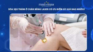 xóa sẹo thâm ở chân bằng laser