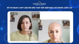app làm hói đầu
