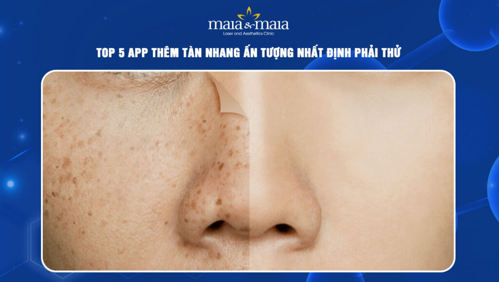 app thêm tàn nhang