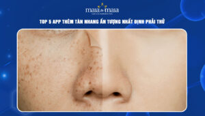 app thêm tàn nhang