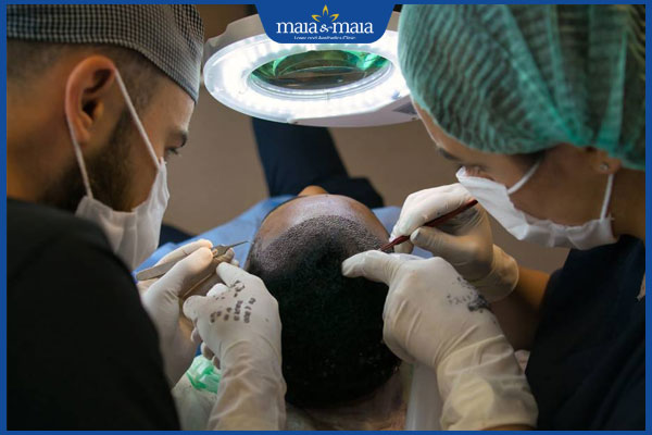 bác sĩ thực hiện cấy tóc