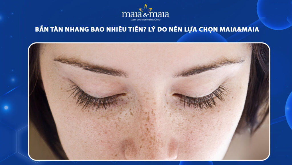 bắn tàn nhang bao nhiêu tiền