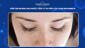 bắn tàn nhang bao nhiêu tiền